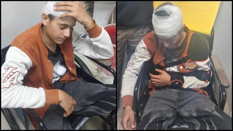 देहरादून में नाम पूछकर कश्मीरी युवक पर हमला, लोहे की रॉड से मारा, सिर फोड़ा, हाथ तोड़ा